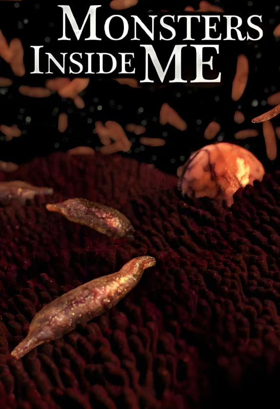 体内的怪物1